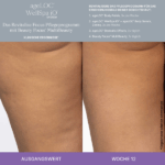Better Together WellSpa iO System Revitalise Focus