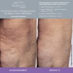 Better Together WellSpa iO System Revitalise Focus